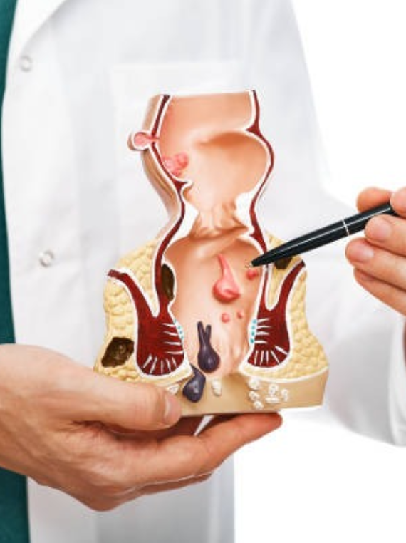Anorectal Treatments 